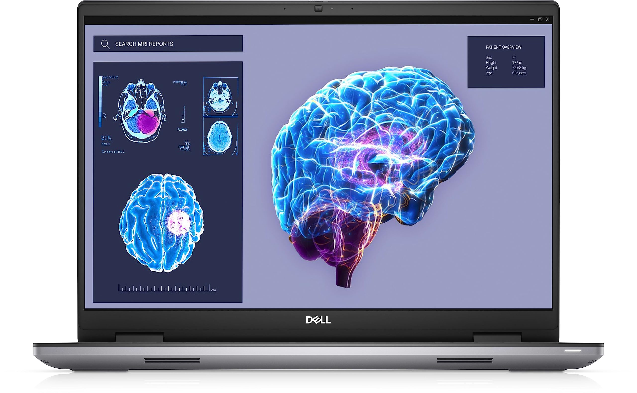 کامپیوتر کاری Dell Precision 7680، Intel Core i9-13950HX vPro، 32 گیگابایت رم / 1 ترابایت حافظه جانبی از نوع SSD، صفحه نمایش 16 اینچ با کیفیت FHD+، گرافیک 8 گیگابایت Nvidia RTX A2000 GDDR6، صفحه کلید با نور پس زمینه 99 کلیدی، ویندوز 11 Pro