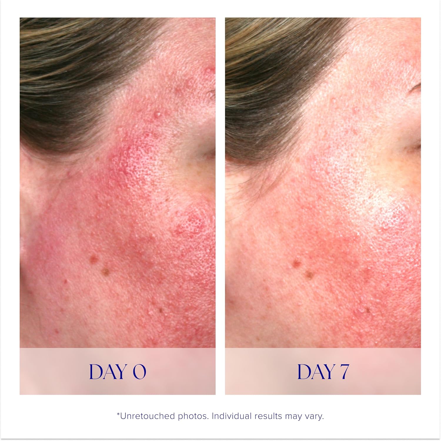B0093NPNO8-image-3