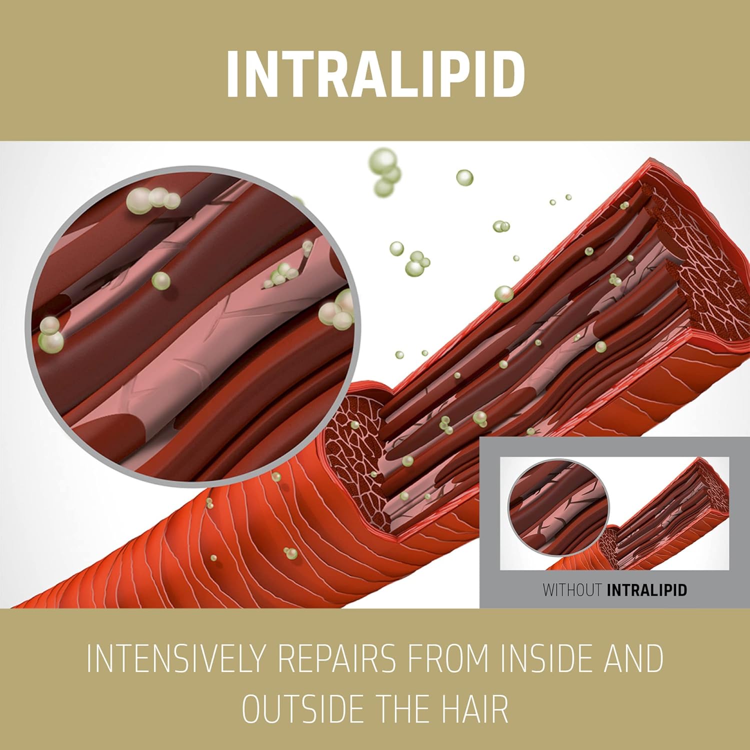 B01MZALRVO-image-2