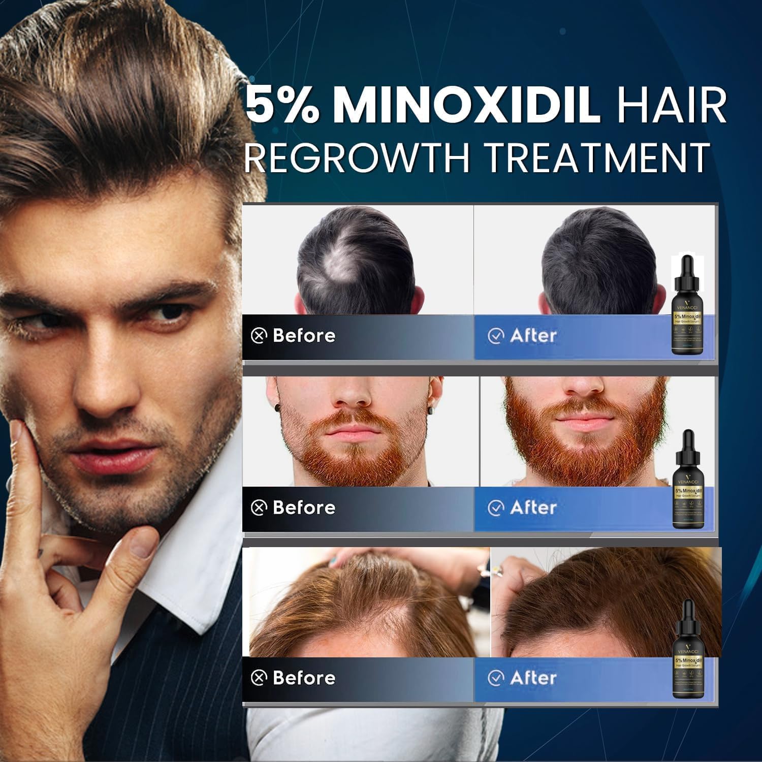 B0G2426CKD-image-5